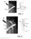 Fig. 06 - Visualization of depth and position of blood vessels and robot guided visualization of blood vessel cross section