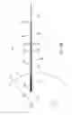 Fig. 35 - Apparatus, systems, and methods for localizing markers or tissue structures within a body