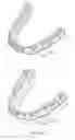 Fig. 02 - Systems, apparatuses and methods for dental appliances with integrally formed features