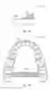 Fig. 19 - Systems, apparatuses and methods for dental appliances with integrally formed features