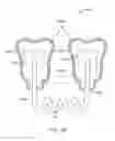 Fig. 28 - Systems, apparatuses and methods for dental appliances with integrally formed features