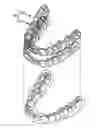 Fig. 01 - Dual aligner assembly