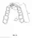 Fig. 02 - Dual aligner assembly