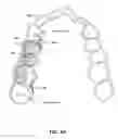 Fig. 08 - Dual aligner assembly