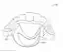 Fig. 01 - Direct fabrication of aligners for arch expansion