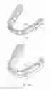 Fig. 02 - Direct fabrication of attachment templates with adhesive