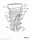 Fig. 02 - Condensing skeletal implant that facilitate insertions