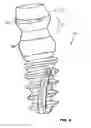 Fig. 09 - Condensing skeletal implant that facilitate insertions