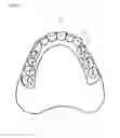 Fig. 02 - ARTIFICIAL TOOTH