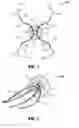 Fig. 02 - Hernia repair device and method