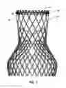 Fig. 06 - Arrangement, a loop-shaped support, a prosthetic heart valve and a method of repairing or replacing a native heart valve