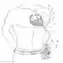 Fig. 01 - Implanting cardiac devices
