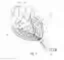 Fig. 04 - Implanting cardiac devices