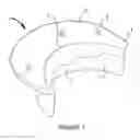 Fig. 02 - Apparatus and method for heart valve repair
