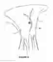 Fig. 09 - Apparatus and method for heart valve repair
