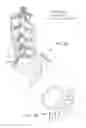 Fig. 44 - Systems, device, and methods for joint fusion