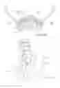 Fig. 71 - Systems, device, and methods for joint fusion