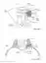 Fig. 97 - Systems, device, and methods for joint fusion