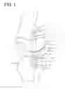 Fig. 02 - Internal joint cavity expander