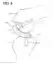 Fig. 07 - Internal joint cavity expander