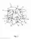 Fig. 02 - Linked Bilateral Spinal Facet Implants and Methods of Use