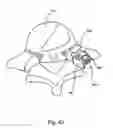 Fig. 45 - Linked Bilateral Spinal Facet Implants and Methods of Use