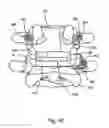 Fig. 49 - Linked Bilateral Spinal Facet Implants and Methods of Use