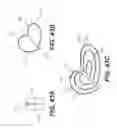 Fig. 33 - Expandable interbody spacer