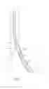Fig. 02 - ANTEGRADE FLOW MAINTENANCE SHEATH