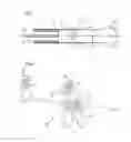 Fig. 02 - Stent placement device