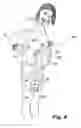 Fig. 07 - Uterine compression devices and methods