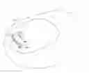 Fig. 01 - Nail correcting device