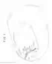 Fig. 02 - Nail correcting device