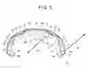Fig. 06 - Nail correcting device