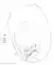 Fig. 07 - Nail correcting device