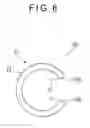 Fig. 09 - Nail correcting device