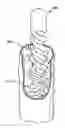 Fig. 01 - SYSTEM AND METHOD FOR INDUCING HYPOTHERMIA WITH CONTROL AND DETERMINATION OF CATHETER PRESSURE