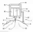 Fig. 01 - Ophthalmological apparatus for the breakdown of eye tissue