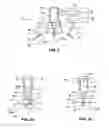 Fig. 03 - Ophthalmological apparatus for the breakdown of eye tissue