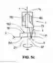Fig. 04 - Ophthalmological apparatus for the breakdown of eye tissue