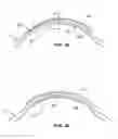 Fig. 08 - Ophthalmological apparatus for the breakdown of eye tissue
