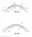 Fig. 09 - Ophthalmological apparatus for the breakdown of eye tissue