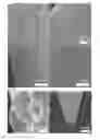 Fig. 01 - Porous acupuncture needle and method for manufacturing same