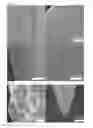 Fig. 03 - Porous acupuncture needle and method for manufacturing same