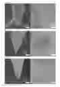 Fig. 04 - Porous acupuncture needle and method for manufacturing same