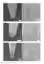 Fig. 05 - Porous acupuncture needle and method for manufacturing same