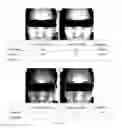 Fig. 07 - CHAYOTE FRUIT CELL FLUID, PREPARATION METHOD THEREOF, SKINCARE AND WRINKLE-SMOOTHING COMPOSITION INCLUDING THE SAME, AND METHOD OF PREPARING WRINKLE-SMOOTHING COMPOSITION