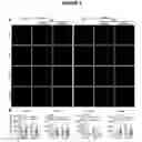 Fig. 07 - Compositions for treating retinal degeneration and methods of production and use thereof