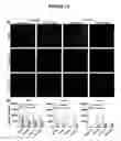 Fig. 12 - Compositions for treating retinal degeneration and methods of production and use thereof