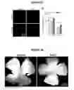Fig. 28 - Compositions for treating retinal degeneration and methods of production and use thereof
